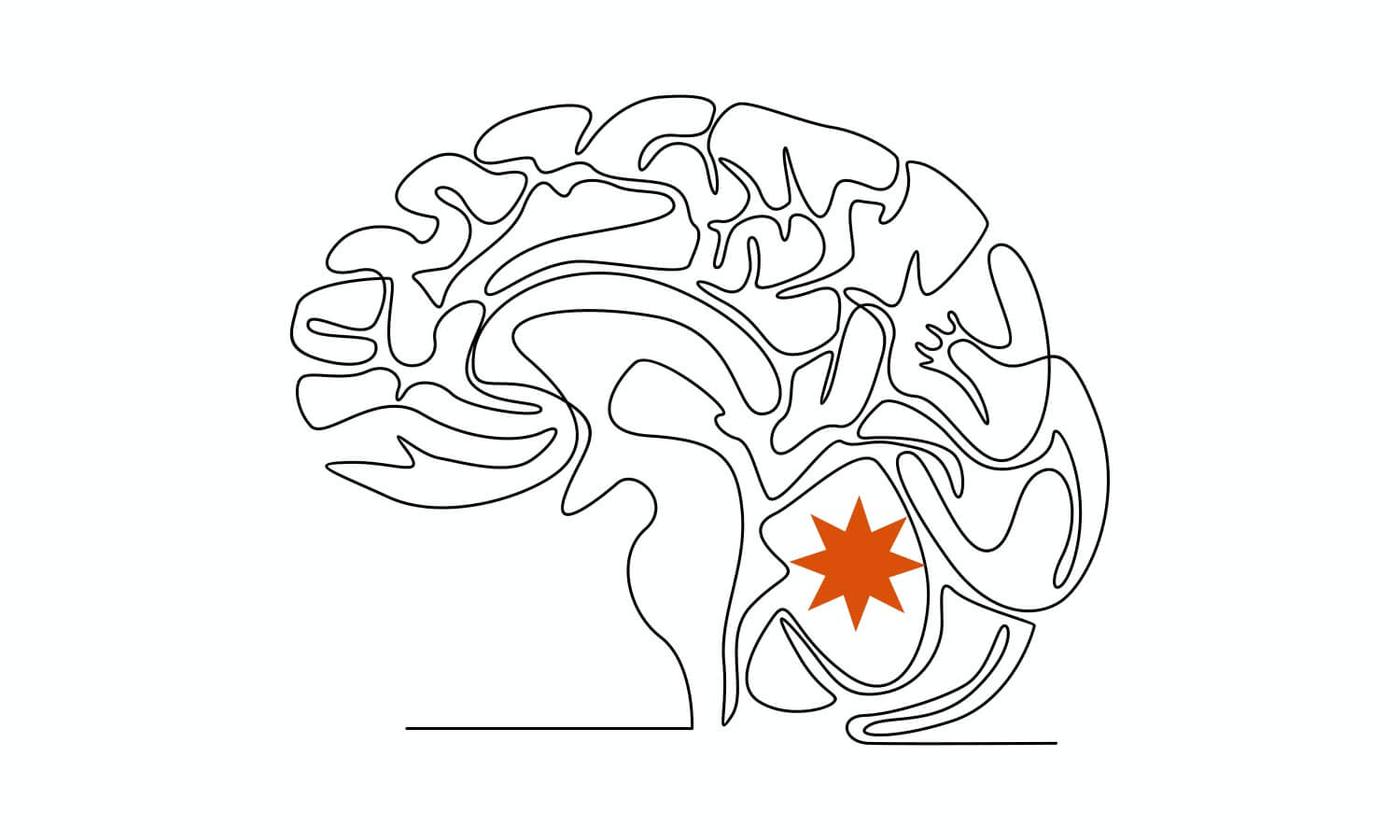 소뇌에-문제가-생긴-뇌