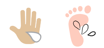 손바닥 발바닥 땀 많이 나는 증상