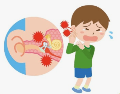 중이염 염증 발생 기전과 청력 저하 증상 및 정밀 판독 단계별 치료 관리