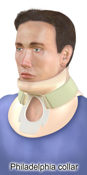 필라델피아 보조기