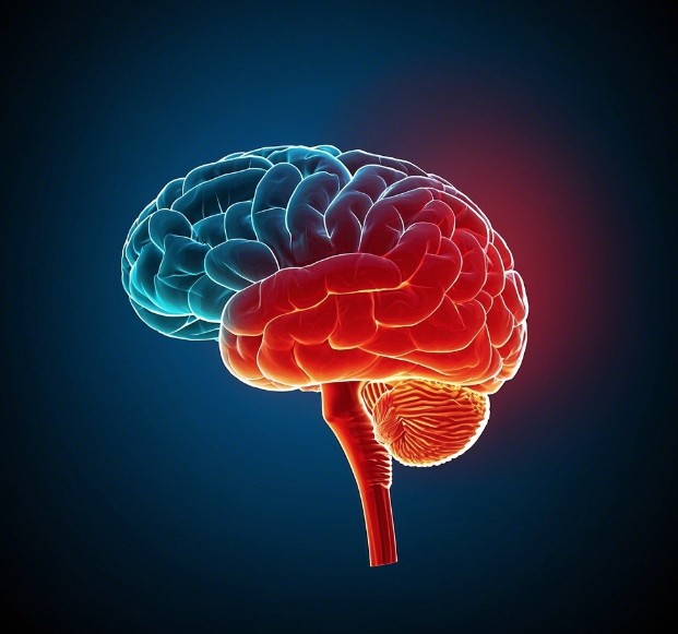 모야모야병 증상12