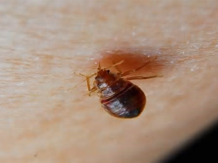 빈대 퇴치 물림 증상