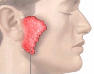 귀밑 몽우리 원인