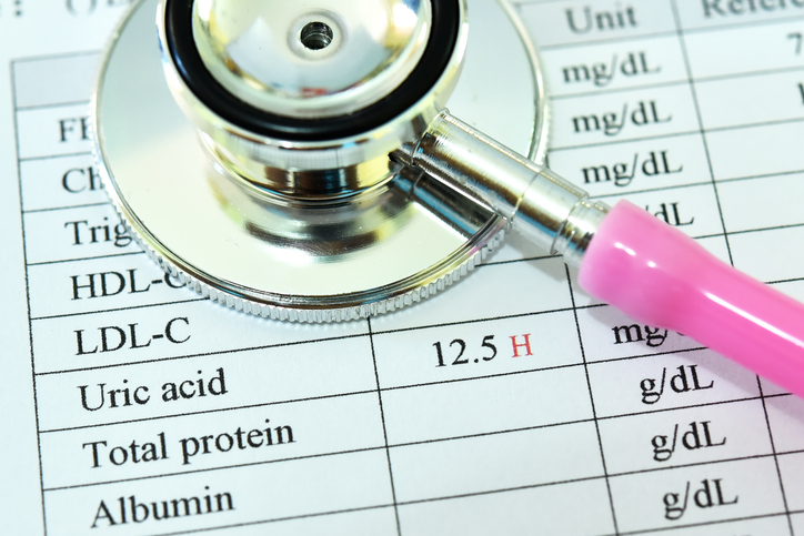 높은 요산 수치