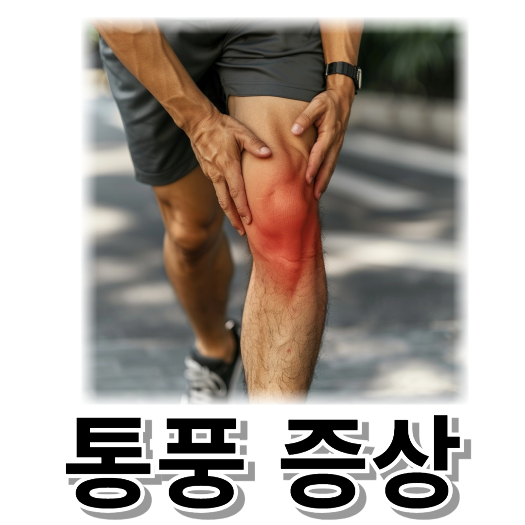 통풍과 관련된 사진입니다.