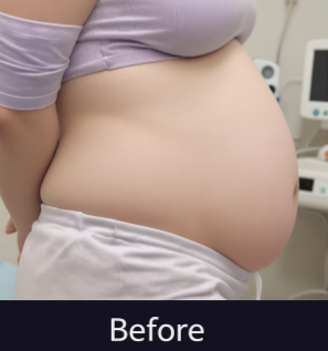 뱃살 감소 가속화