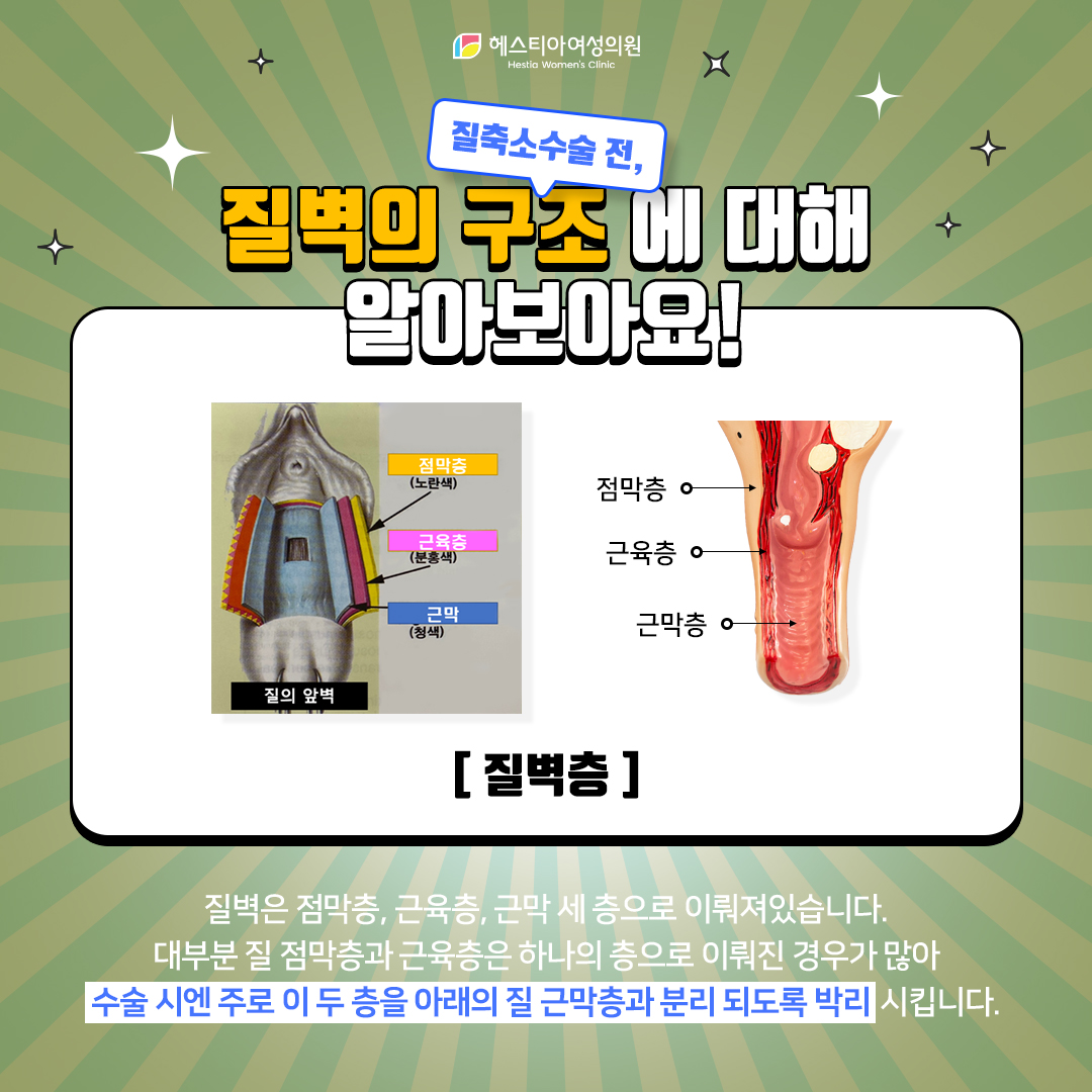 질벽의 구조에 대해 함께 알아보아요!