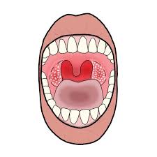 목에 이물감 느껴지는 증상