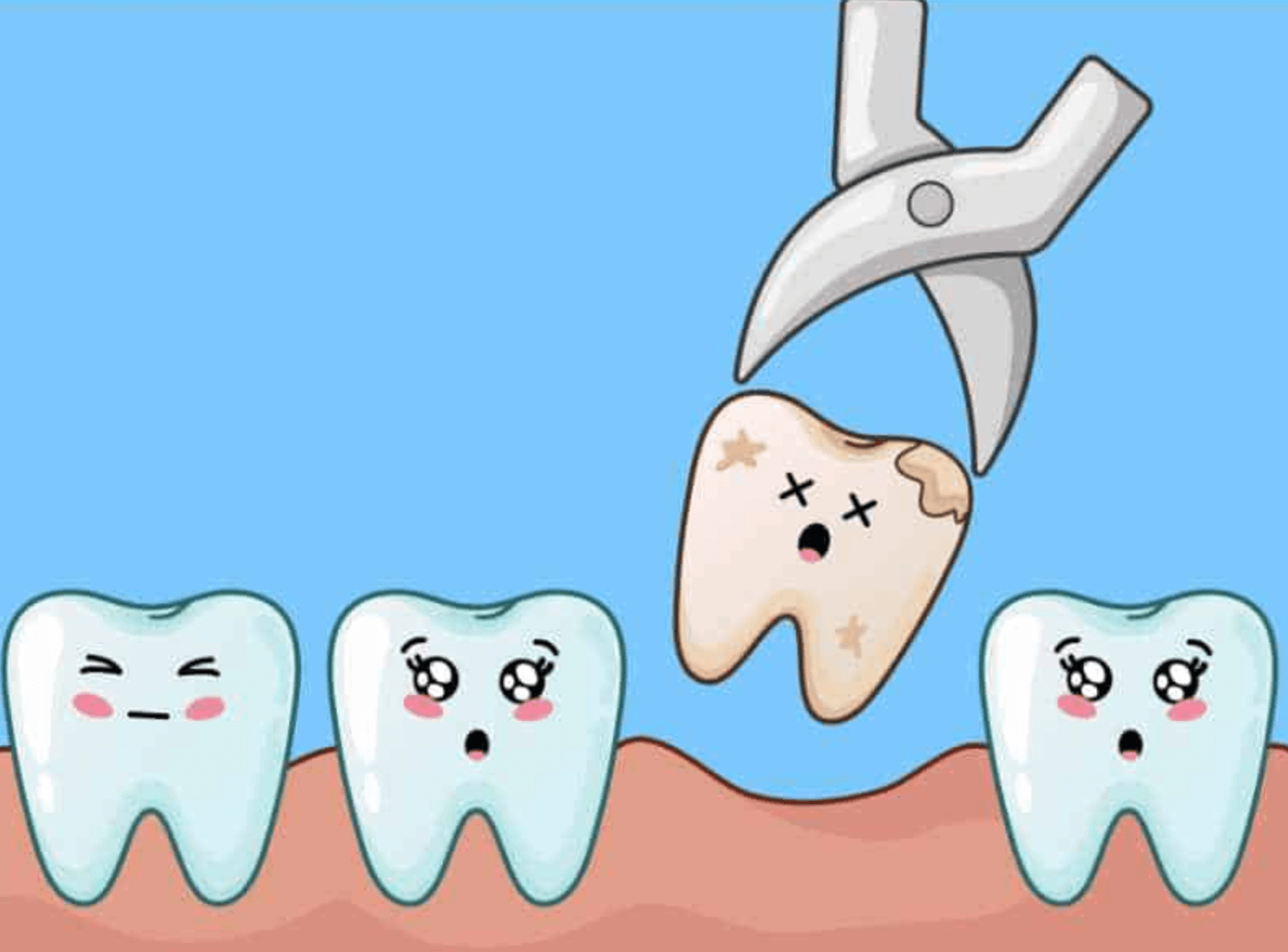 어금니 발치 후기