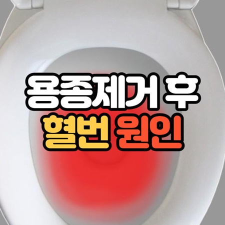 대장내시경 용종제거후 혈변