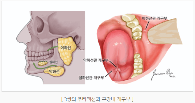 설암 침샘암 편도암 초기증상