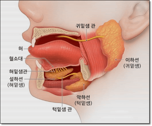 침샘염