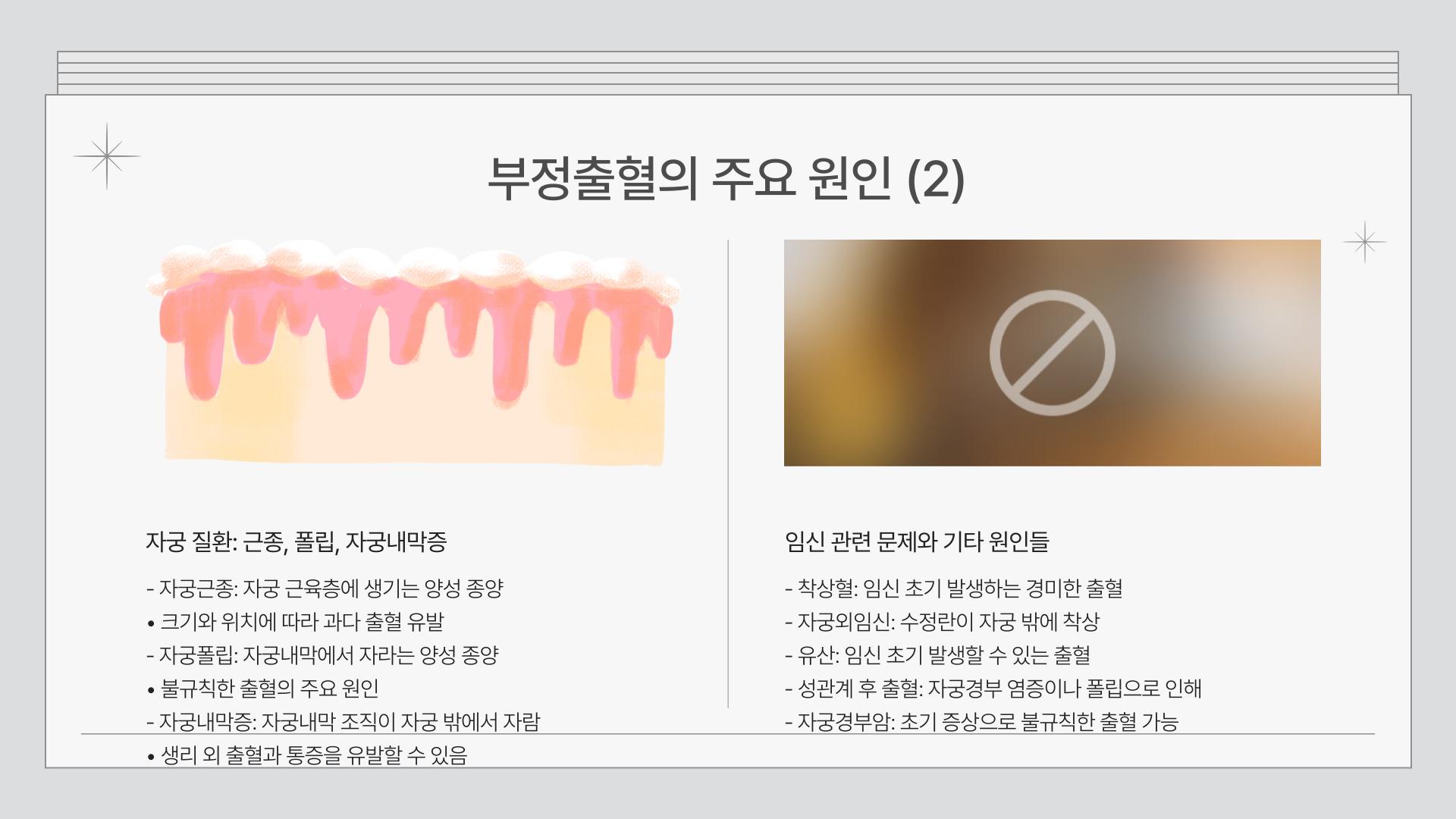 부정출혈과 생리 차이