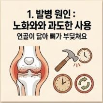 류마티스 관절염 초기증상