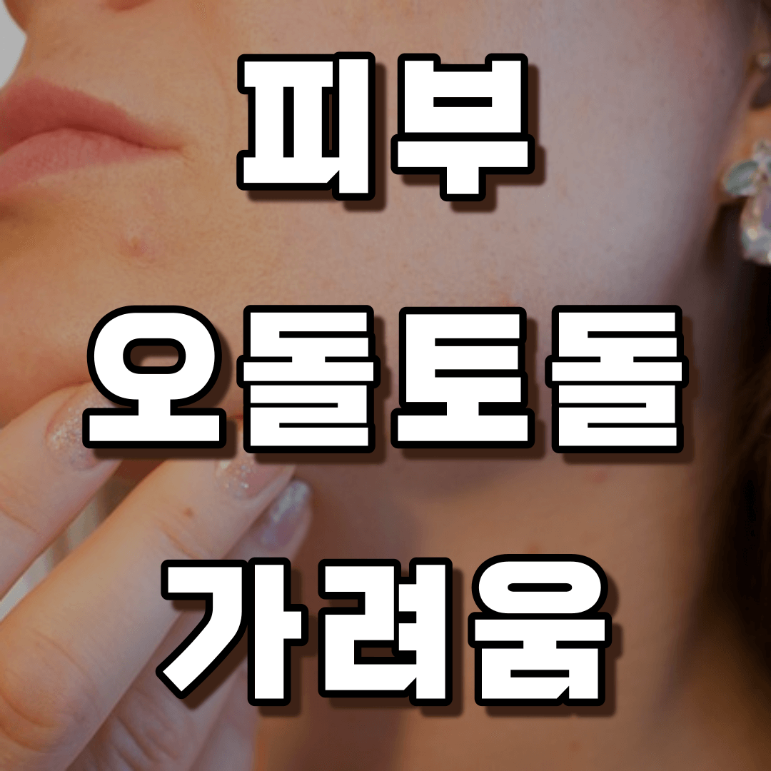피부 오돌토돌 가려움