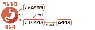 위내시경검사