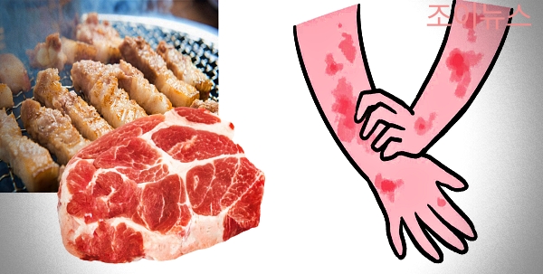 돼지고기 식품알레르기 증상