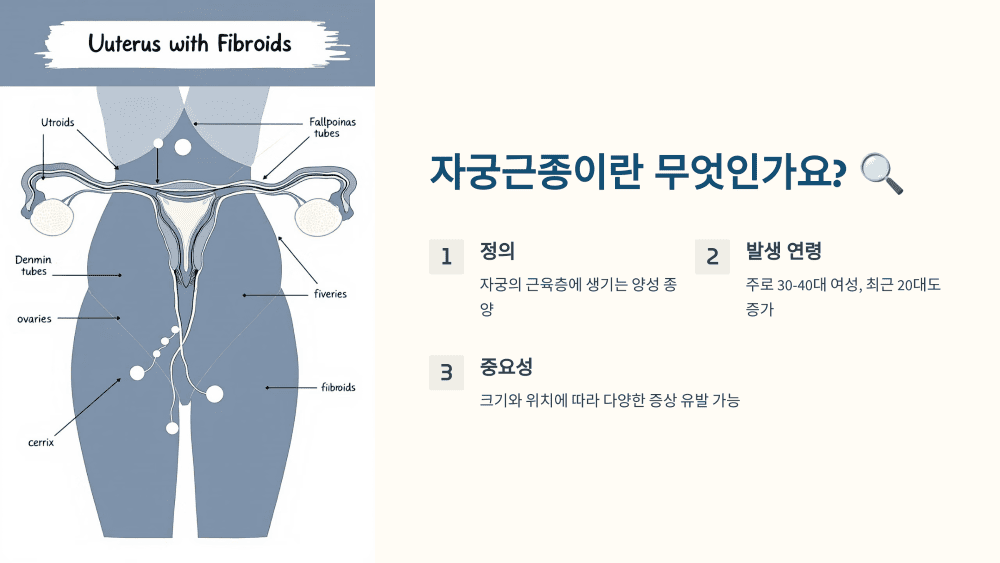 자궁근종이란 무엇인가요?