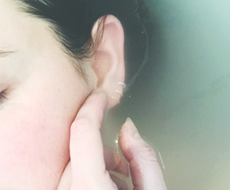 히알루론산 : 피부 보습