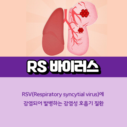 RS바이러스