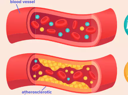 베타-시토스테롤-효능-부작용-건강