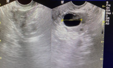 배란 확인 방법