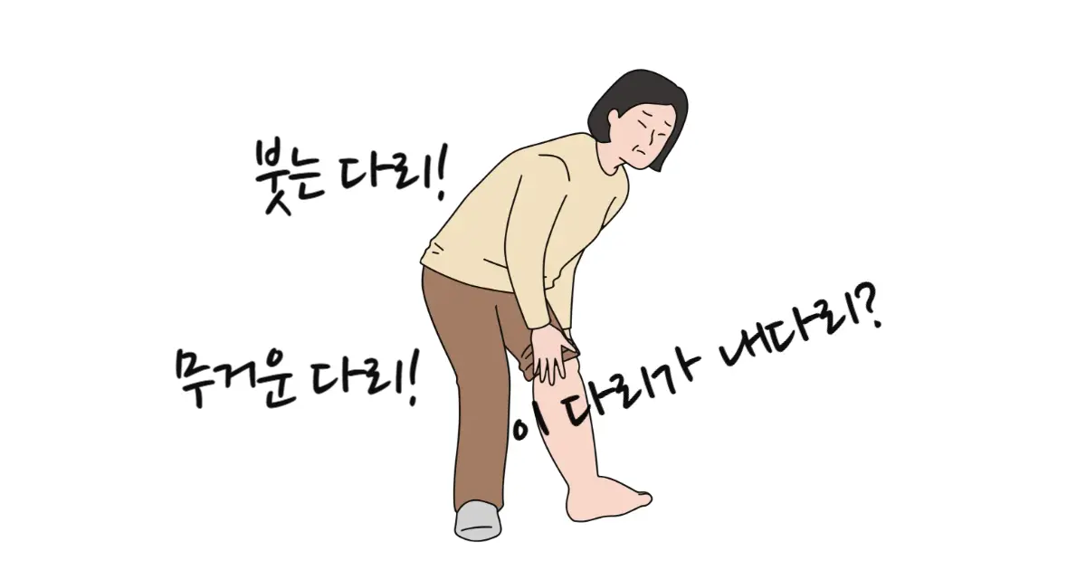 하지정맥류 증상