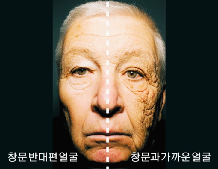 썬팅을 안하면 생기는 일