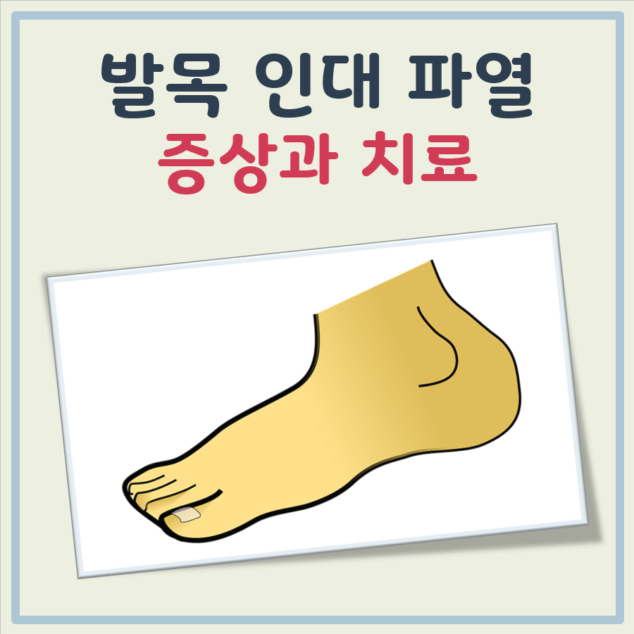 발목 인대파열 증상과 치료기간, 그리고 치료방법 정리 대표 이미지
