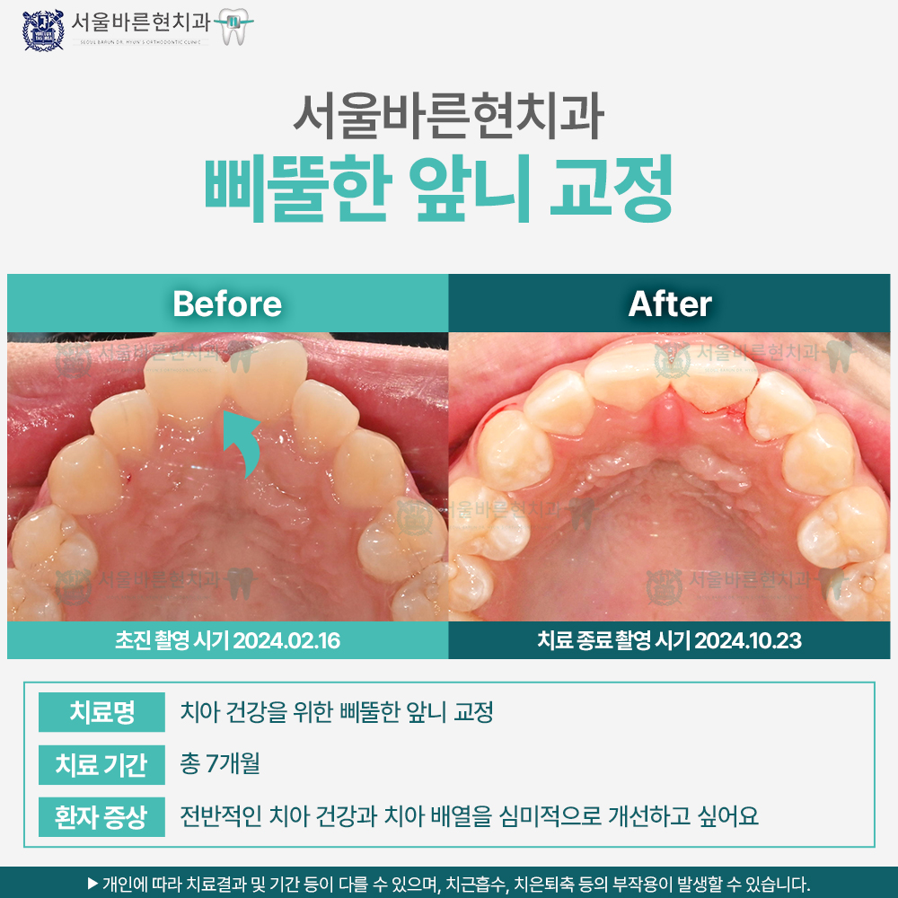 해운대교정치과