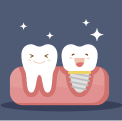 임플란트 시술기간