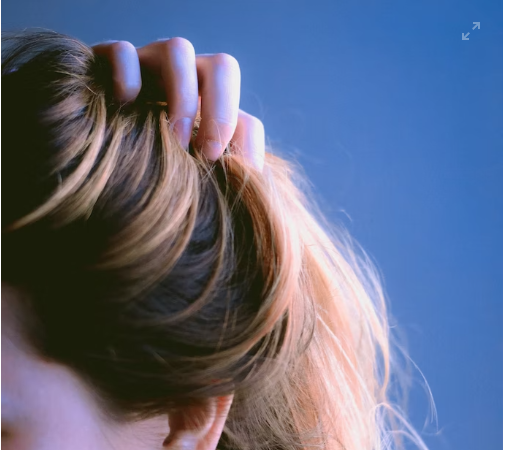 비듬이 생기는 이유와 치료법