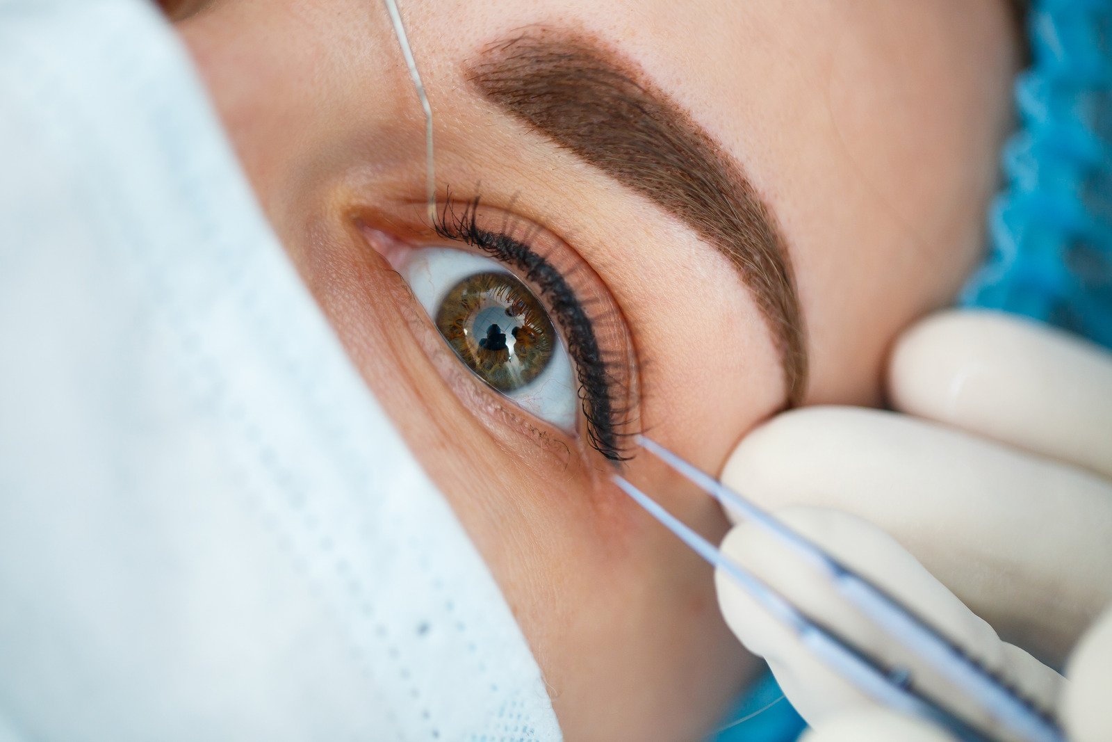 눈매교정: 또렷한 눈매와 생기 있는 인상을 만드는 방법