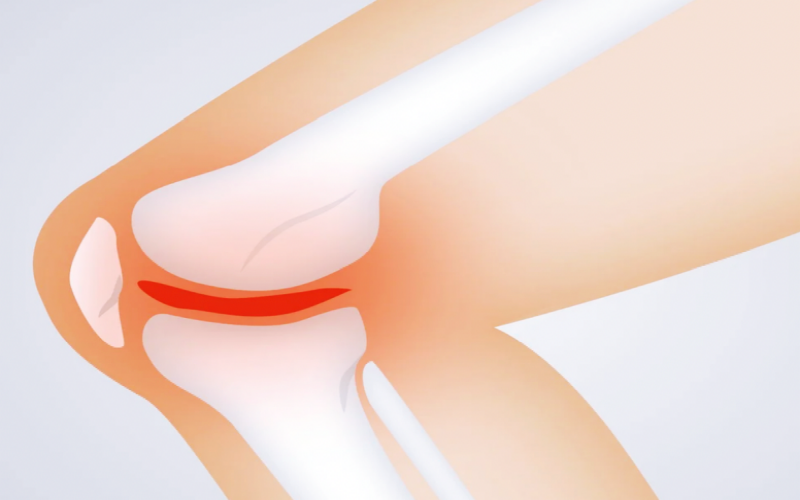 무릎-관절이-아픈-이미지