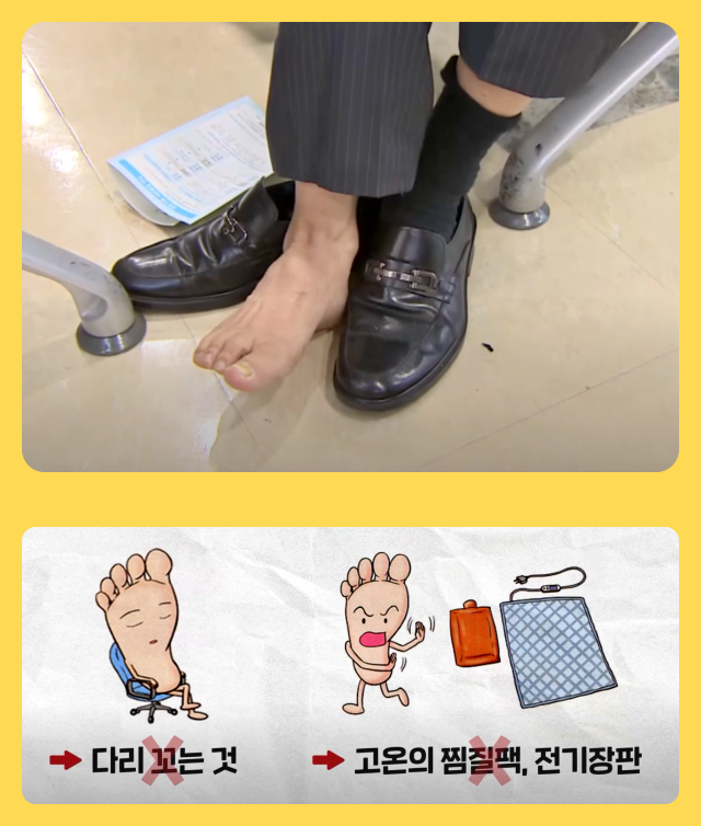 발이 싫어하는 행동은 하지 맙시다! 너무 딱 맞는 신발신기, 다리 꼬기, 찜질팩과 전기장판에 장시간 노출하기