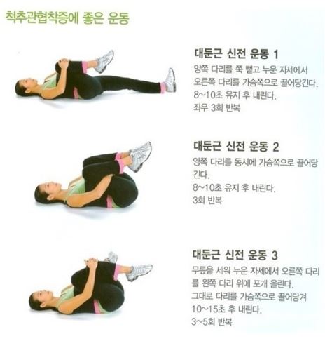 척추관협착증 치료방법 및 운동법