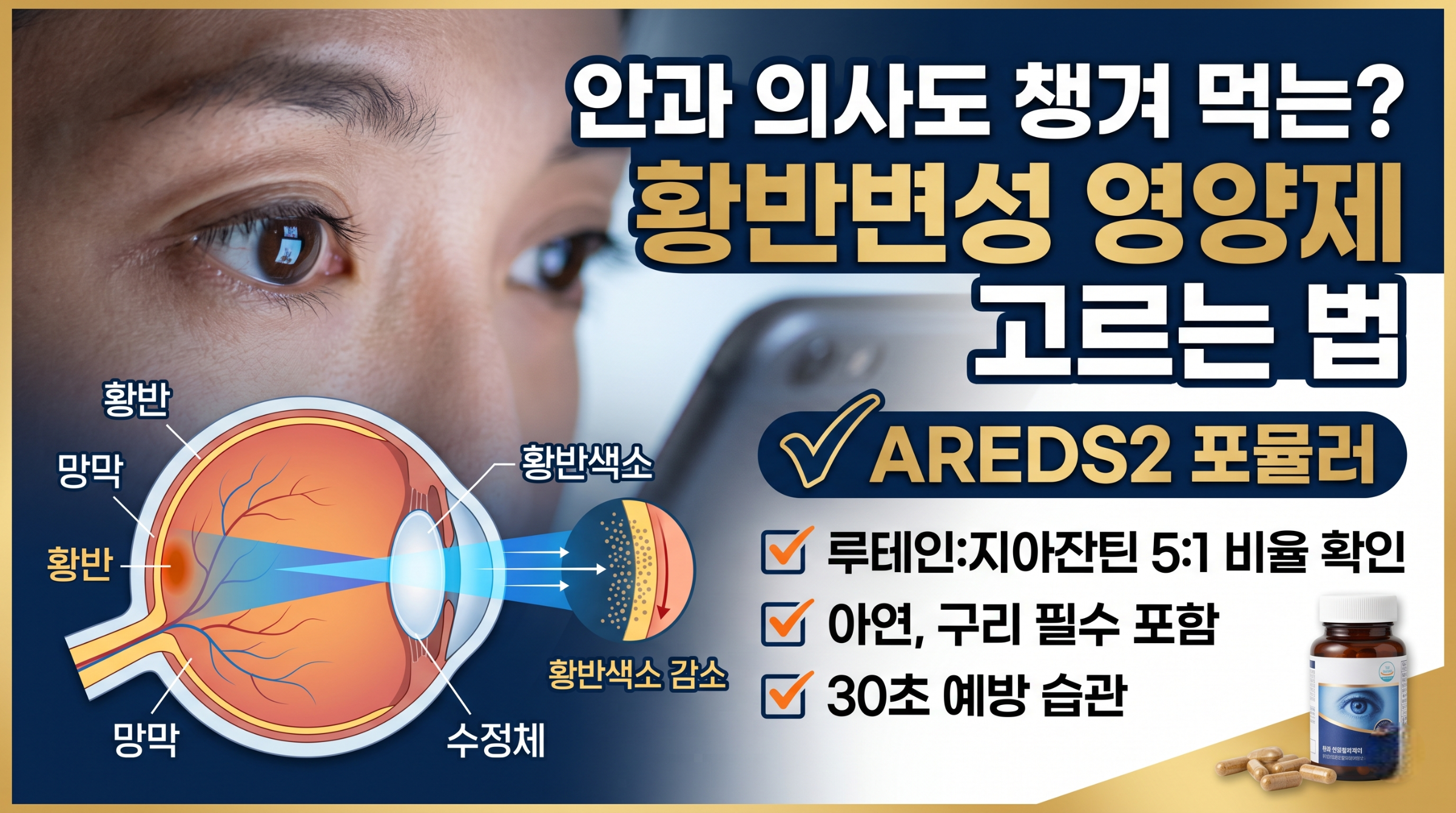 노안 초기증상, 황반변성 영양제 추천, 루테인 지아잔틴 비율, AREDS2 포뮬러, 눈 건강 예방법
