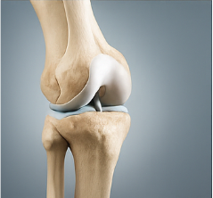 철갑상어 콘드로이친