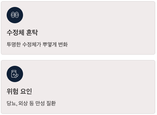 백내장 초기 수정체 혼탁