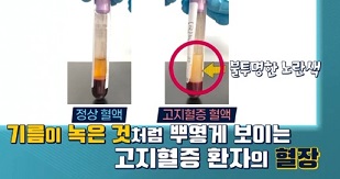 고지혈증혈액
