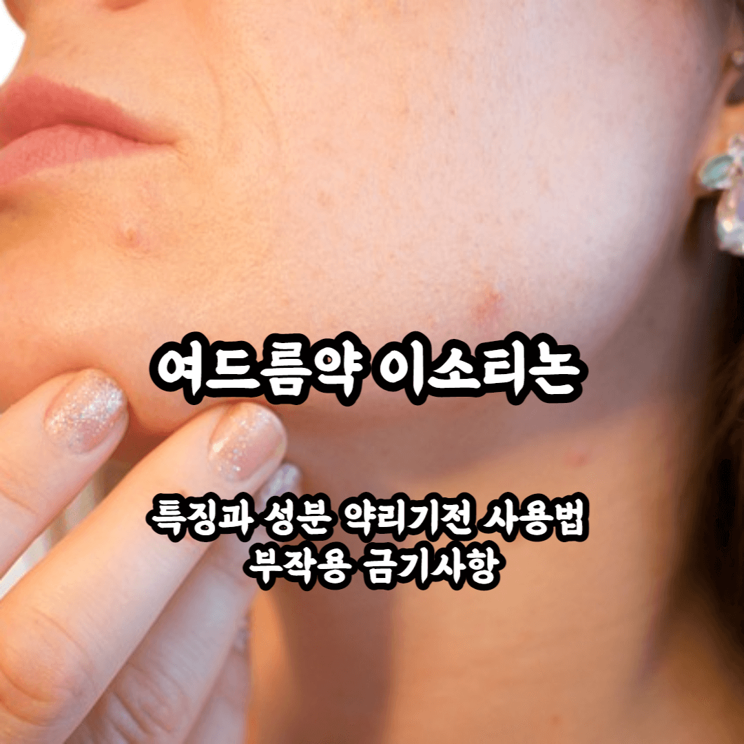 여드름약 이소티논 특징과 성분 약리기전 사용법 부작용 금기사항까지 한번에 알아보자