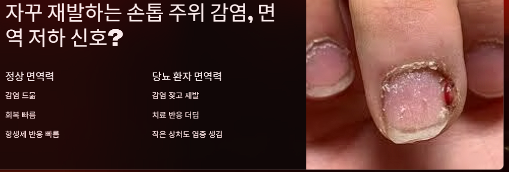 자꾸 재발하는 손톱 주위 감염, 면역 저하 신호?