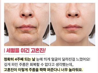 고혼진 화장품 가격, 성분, 효능 까지 완벽 분석!