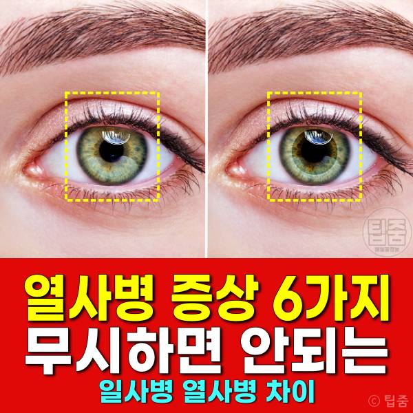 열사병 증상 일사병 열사병 차이