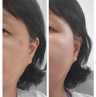 쿠션 사용 전과 후의 피부 비교