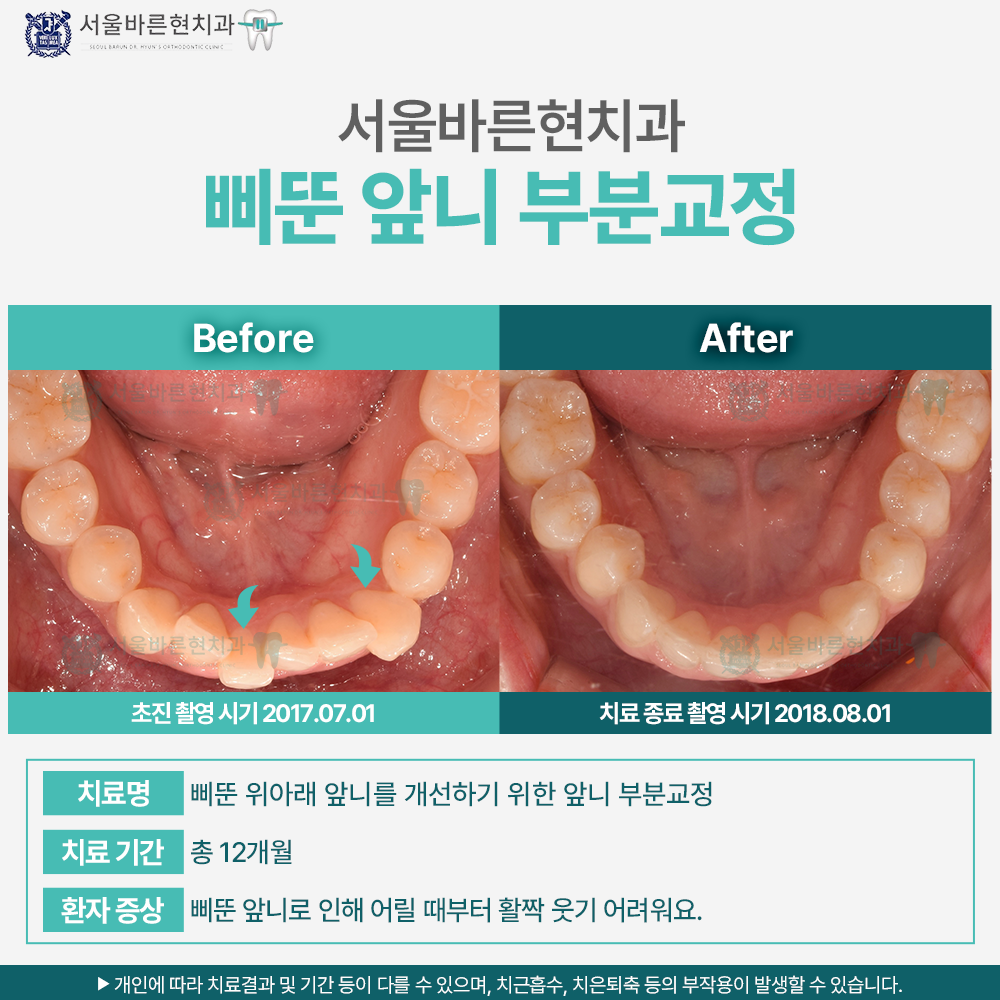 해운대교정치과