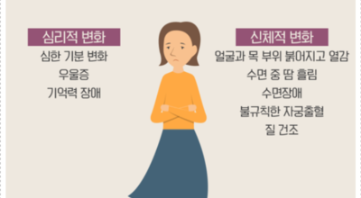 폐경기이미지
