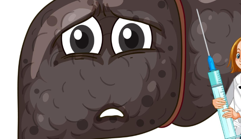 담도 폐색 증상