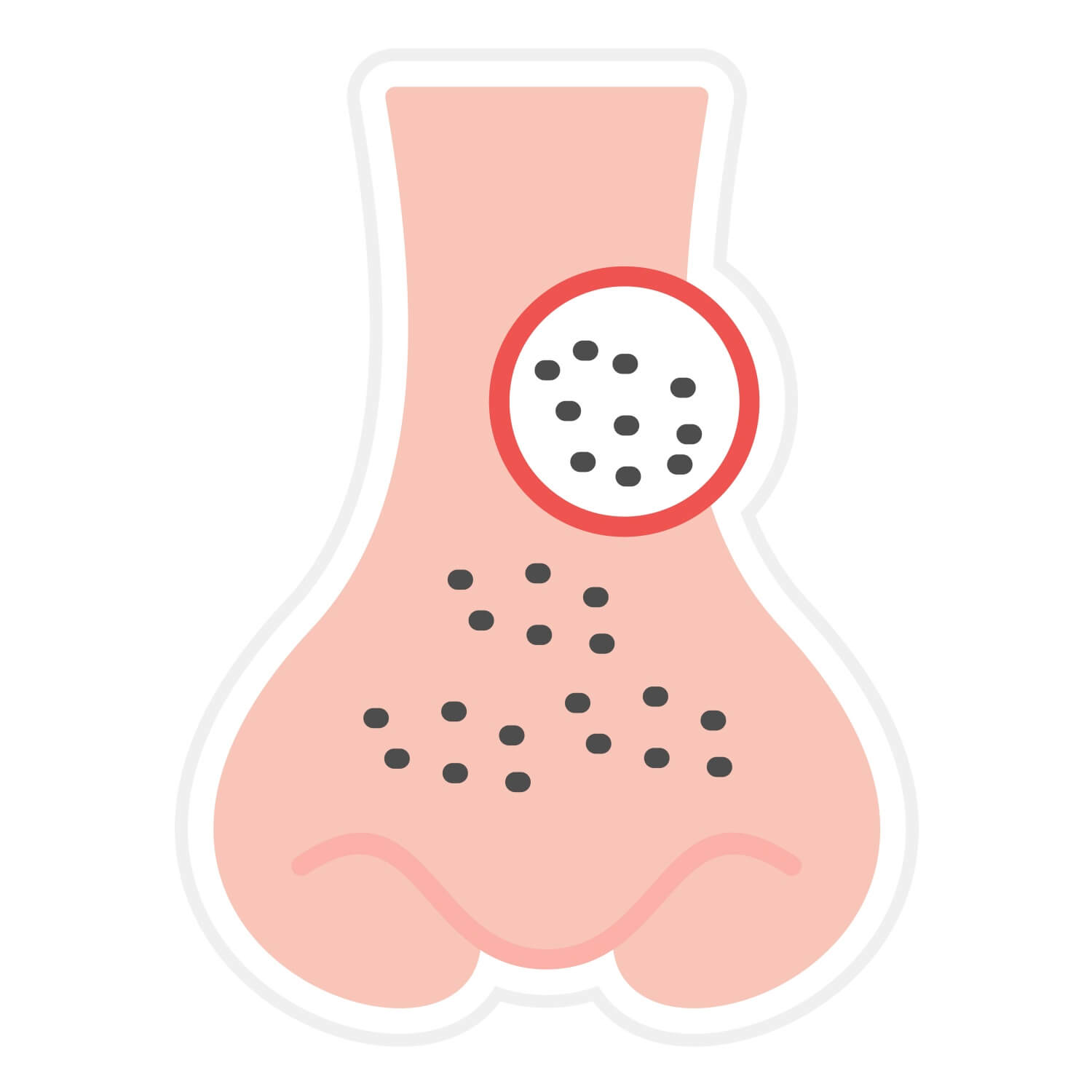 코에-있는-블랙헤드