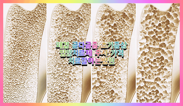 골다공증 치료 병원 영양제